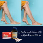 ⁦الباقة الرياضية المميزة (أوميغا 3 + كوإنزيم Q10) - دعم متكامل للدوالي والأداء الرياضي⁩ - الصورة ⁦3⁩